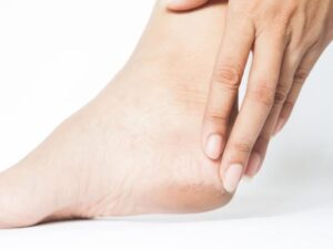 Melhor creme para pés ressecados e rachados