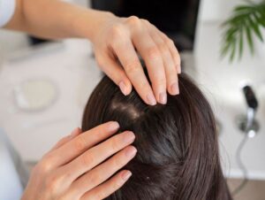 Shampoo para dermatite seborreica